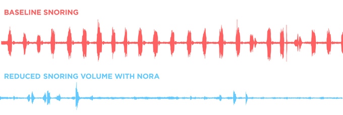 kickstarter nora the smart snoring solution